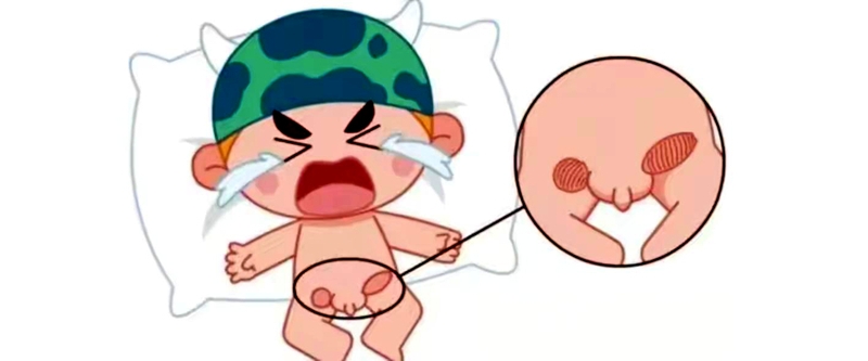 小儿疝气治疗黄金期来临！